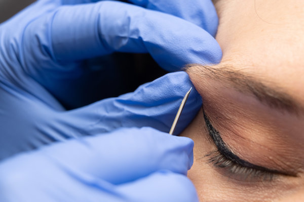 Close-up of an eyebrow piercing in progress